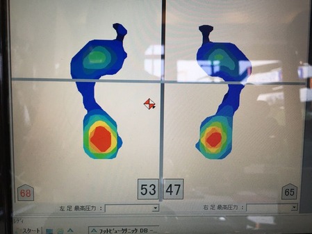 その後