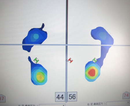 フットビュー
