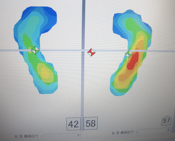 フットビュー