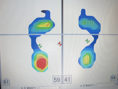 フットビュー