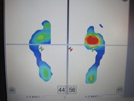 フットビュー