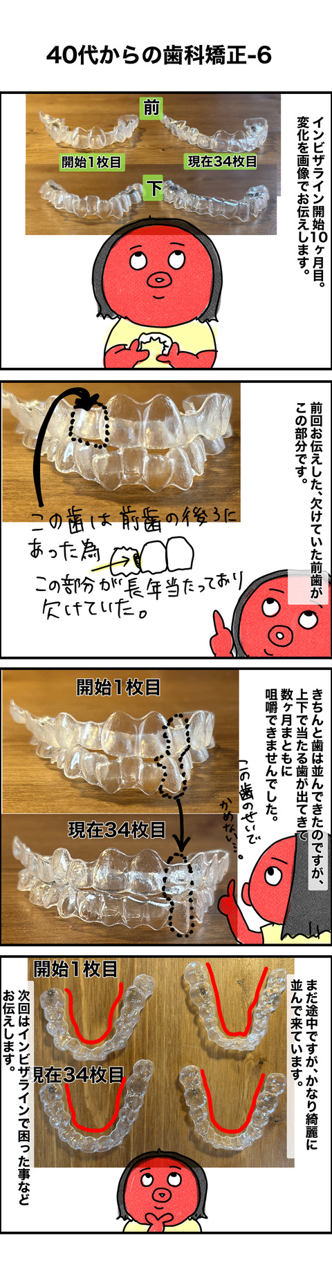 矯正6