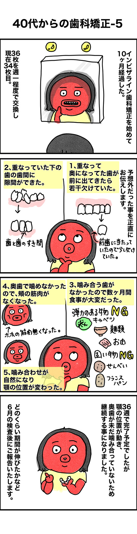歯科矯正5