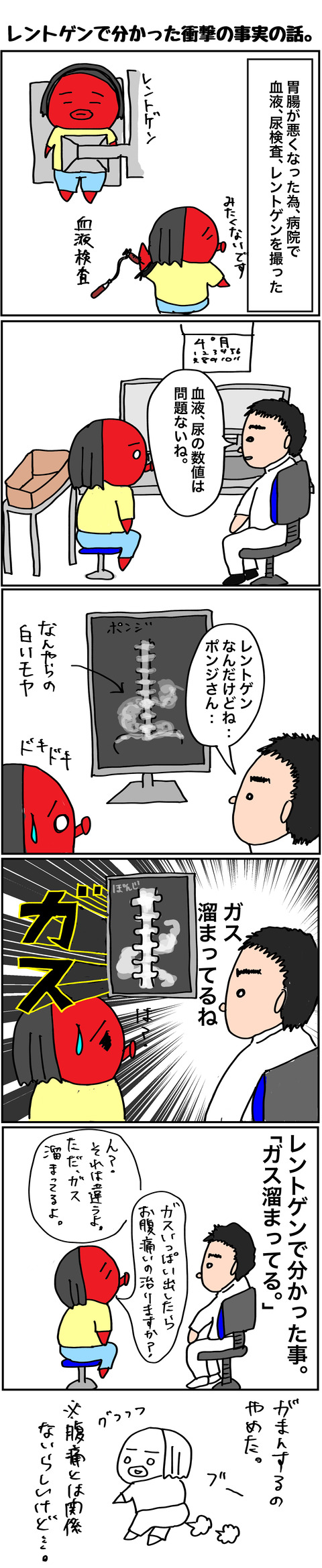レントゲン