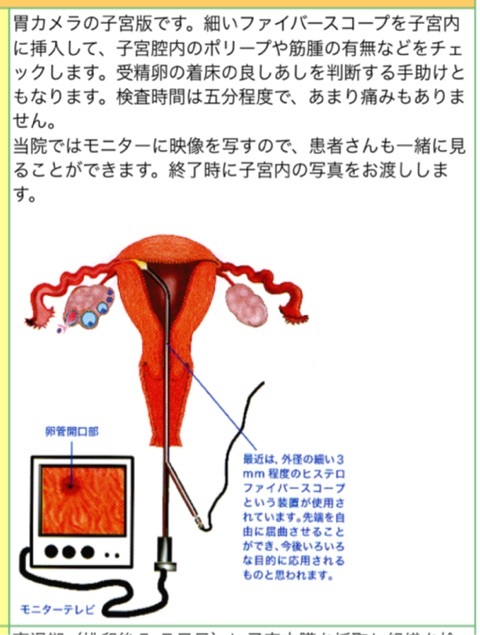 {CAE11F89-4C01-4AB0-B19A-C4836E1885E8:01}
