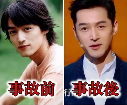 フー・ゴー_事故前、事故後(華流芸能HEASLINEより)