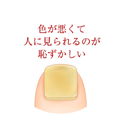 zanmira_nail7