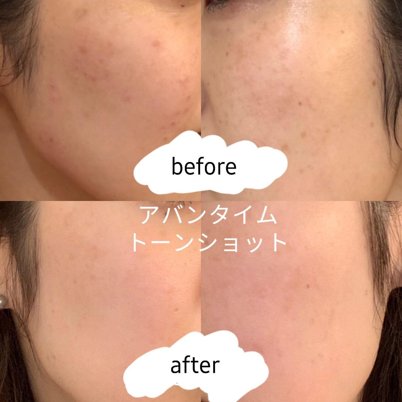 大木製薬 アバンタイム 大木製薬 アバンタイム トーンショットクリーム