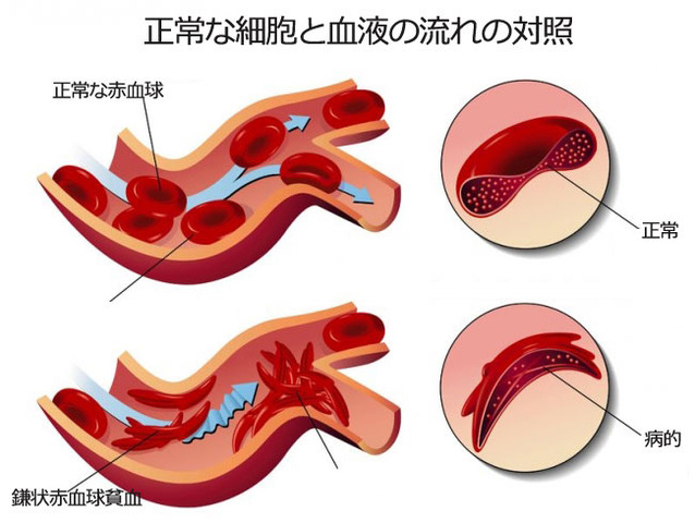 #アンネの法則 ■枠毒デドックス研究。太陽呼吸法。細胞の寿命で新生細胞に入れ替える