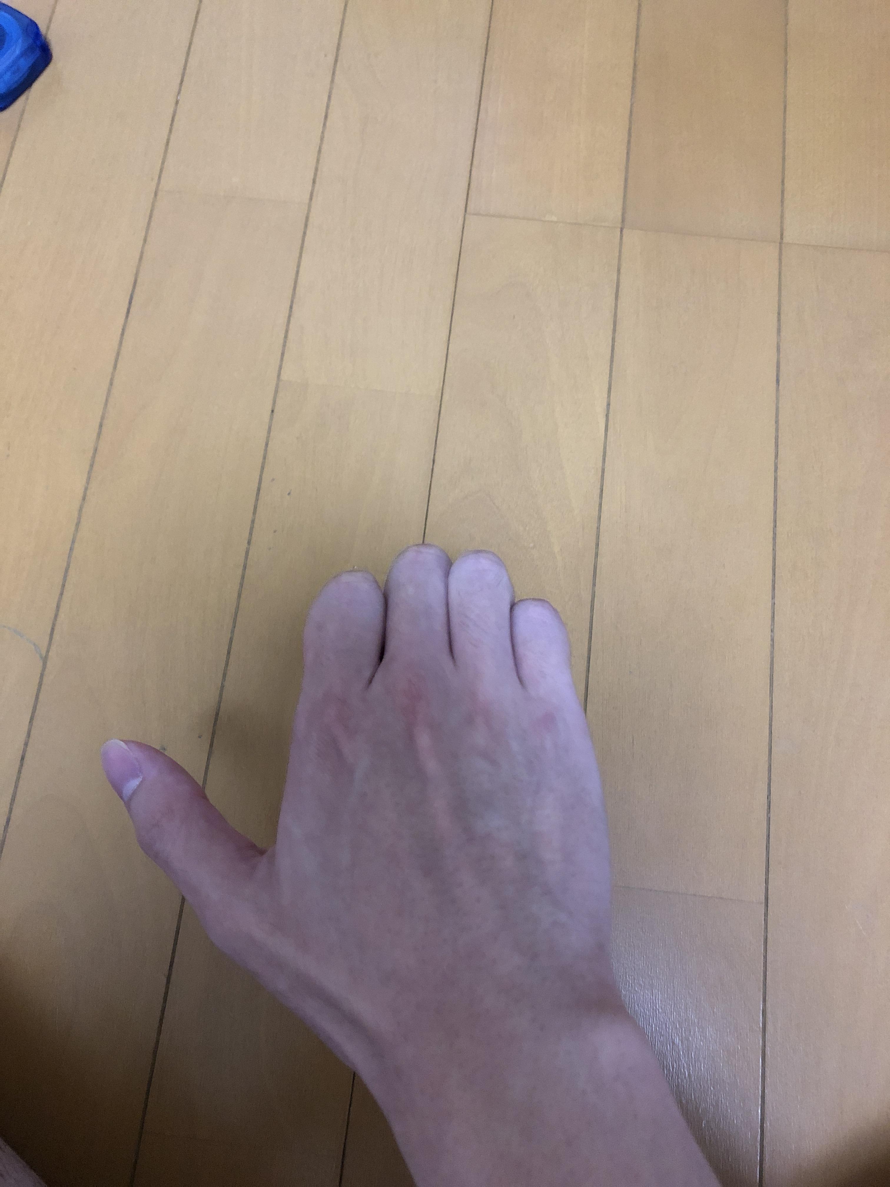 画像 ワイ元ヤクザ指を詰める なんjワールド 画像 ワイ元ヤクザ指を詰める なんjワールド