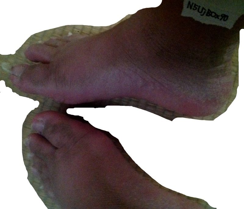 閲覧注意 ７年以上風呂に入ってないせいで毛穴詰まって汗かけないからヤバイ なんjワールド