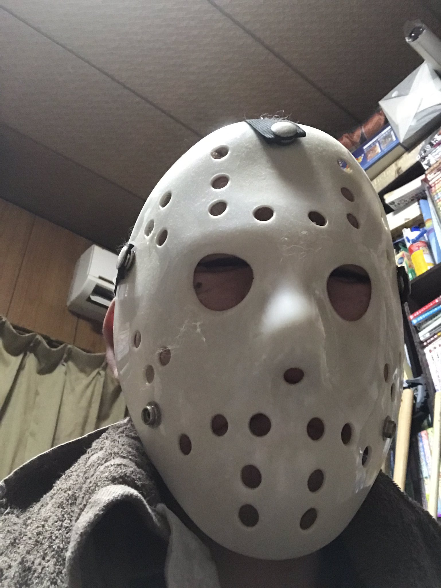 閲覧注意】彡(｡)(；)「頭カユいんやが見てくれないか？」 : なんJワールド