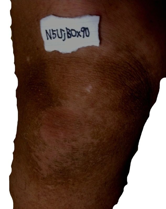 閲覧注意 ７年以上風呂に入ってないせいで毛穴詰まって汗かけないからヤバイ なんjワールド