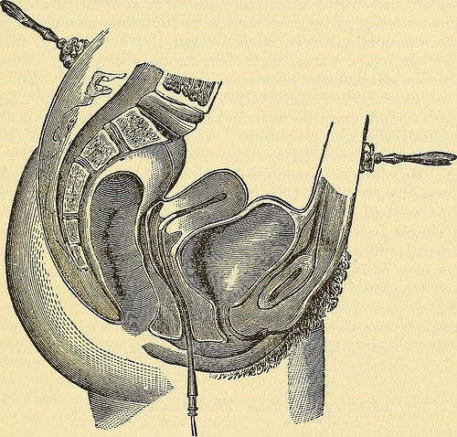 昔の医学書 看護書より リアルなイラストで 産婦人科学を ピティナ 丸太いずみの 医療プレイ研究所part 2 昔の医学書 看護書より リアルなイラストで 産婦人科学を ピティナ 丸太いずみの 医療プレイ研究所part 2