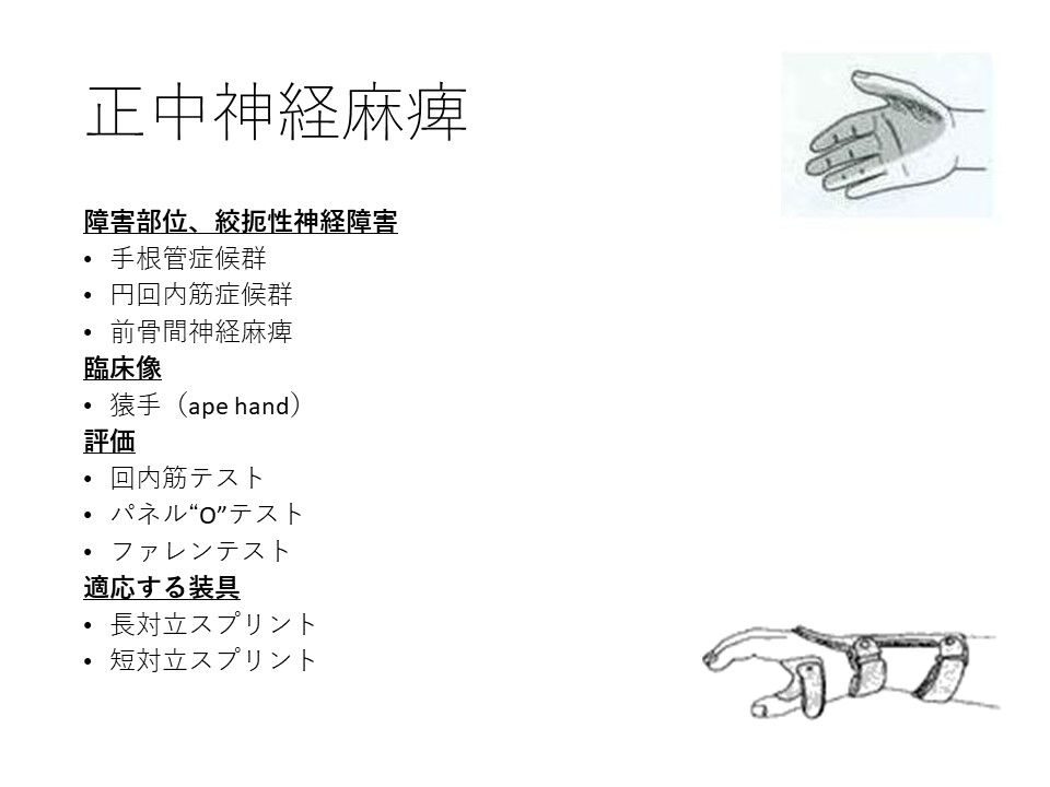 上肢の末梢神経障害 Ptotsへまとめた資料を共有するぶろぐ 上肢の末梢神経障害 Ptotsへまとめた資料を共有するぶろぐ