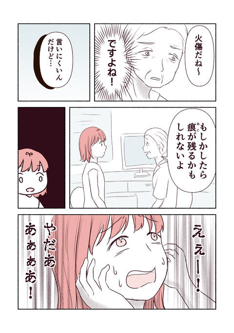 美容室で火傷した話_出力4-6_014