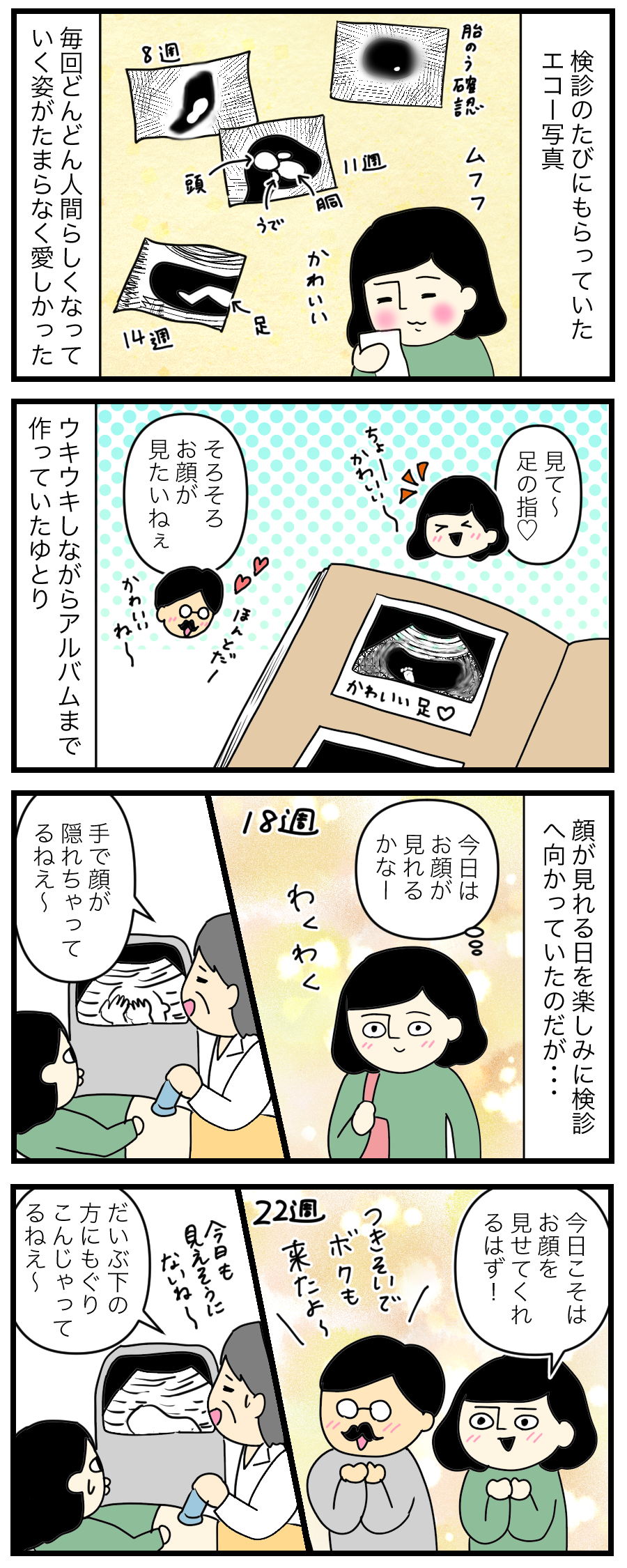 妊娠レポ12 エコー写真の行方 ゆとりちゃんのポンコツダイアリー Powered By ライブドアブログ