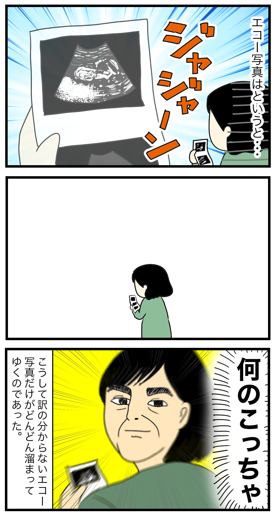 妊娠レポ12 エコー写真の行方 ゆとりちゃんのポンコツダイアリー Powered By ライブドアブログ