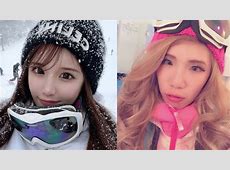 整形総額2000万円超えモデル！ウマ顔ブスが見せる大変身、美の軌跡