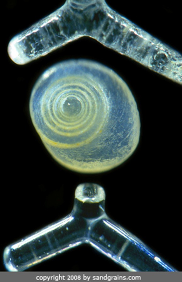 Spine-Spicules1