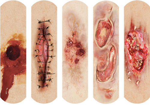 ベスト50 傷 イラスト リアル アニメ画像について