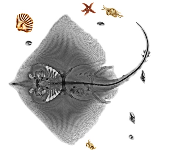 xray15