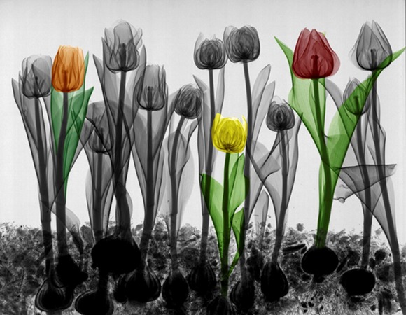 xray1