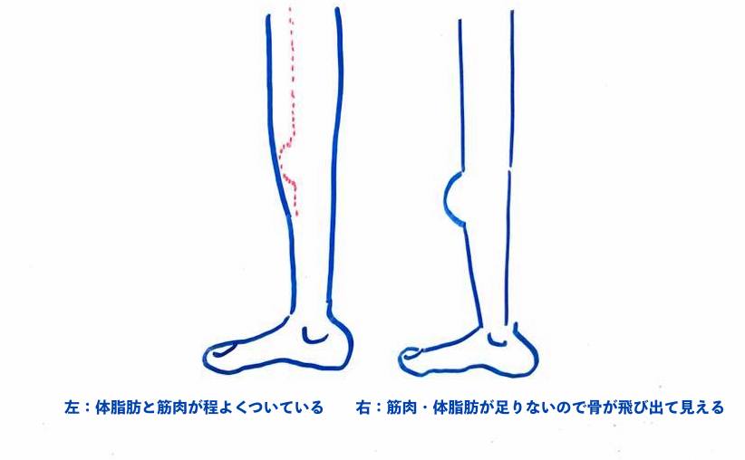 膝が出ている と注意された時の原因と対処法 札幌の悩めるバレエ フィギュアスケート ダンサーの為の情報箱
