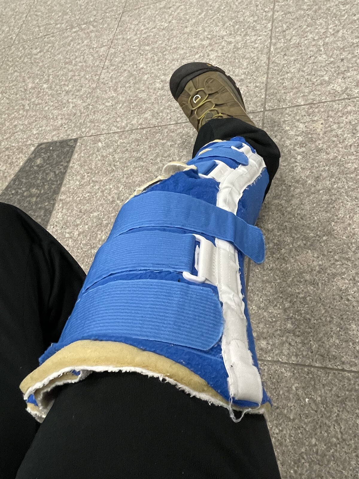 前十字靭帯断裂DAY3 : 札幌の悩めるバレエ•フィギュアスケート