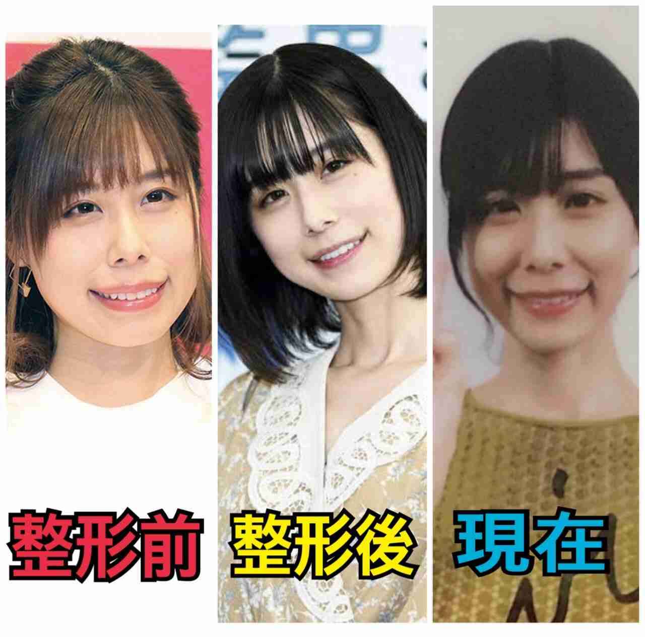 美容整形を批判するネットの声に フット岩尾望の 極論 が反響呼ぶ Girls速報 美容整形を批判するネットの声に フット岩尾望の 極論 が反響呼ぶ Girls速報