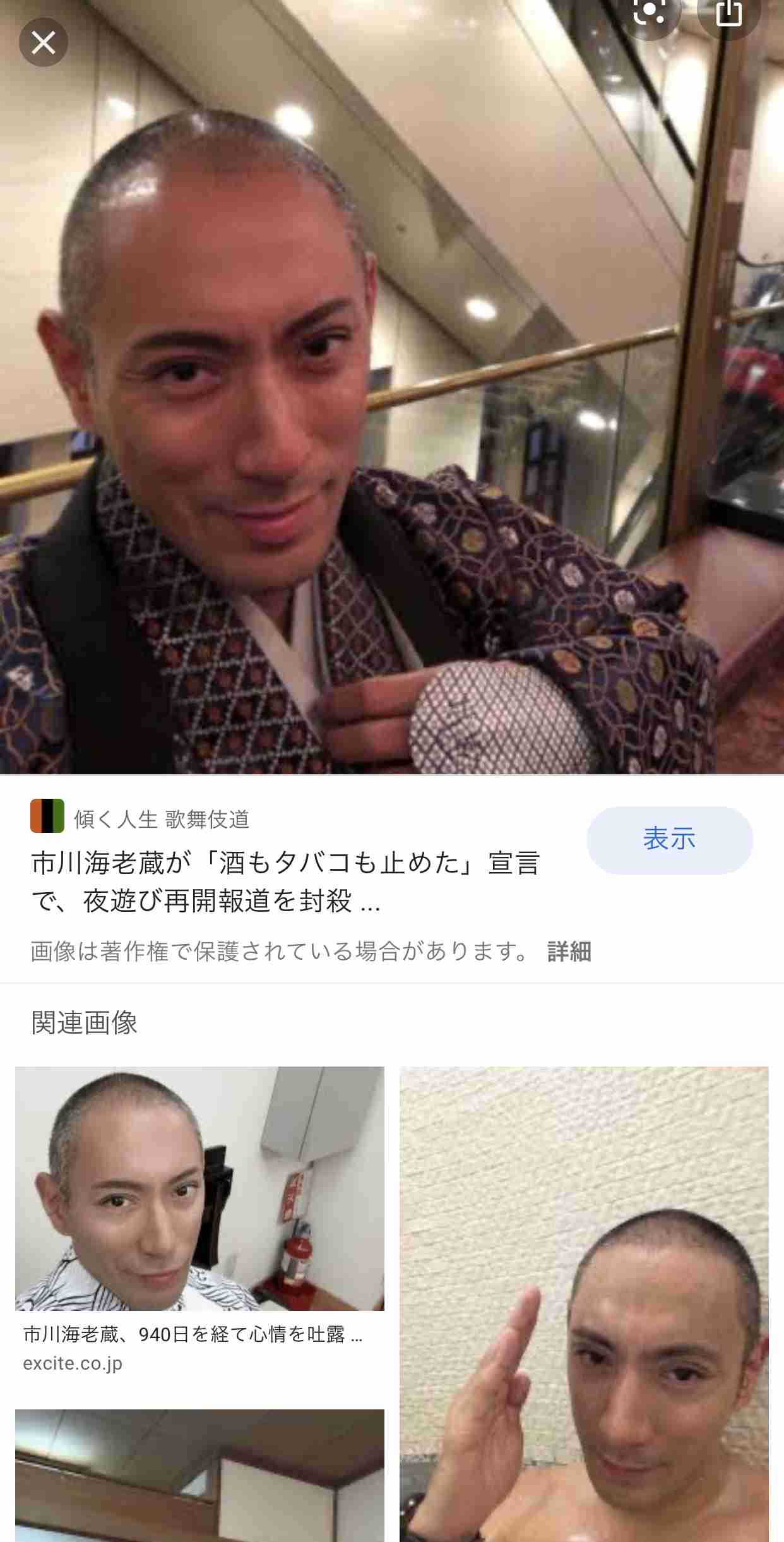 市川海老蔵 整形疑惑 する暇あるかーーい Girls速報