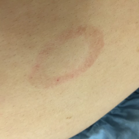 20150226_alergy_IMG_0493