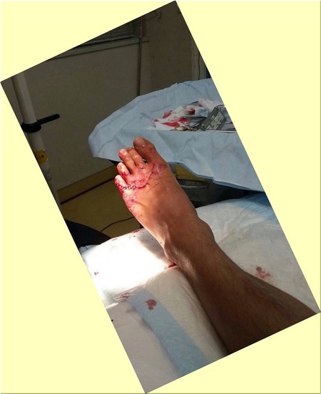 サメの歯形01-720