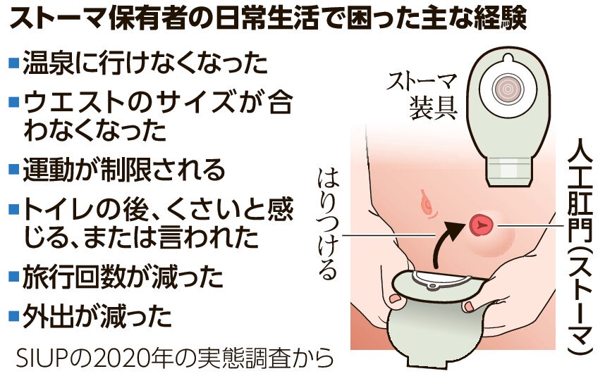 松本人志(62歳)さん、大腸がんで人工肛門を造設　もう旅行に行けない…