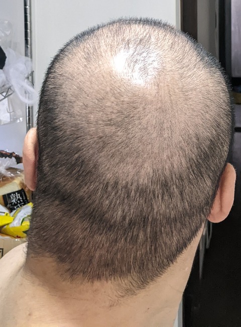 【画像】最近の弱者男性の髪型、全部これｗｗｗｗｗ