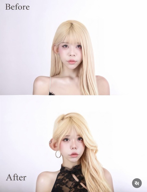 【画像】耳整形が女子の間で流行の兆しｗｗｗｗｗｗｗｗ