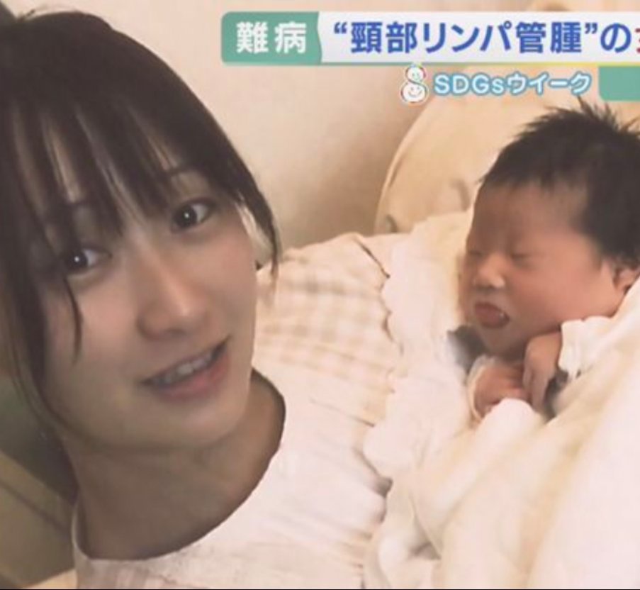 【画像】娘が障害児だと分かったママさん、目が変わり果ててしまう...