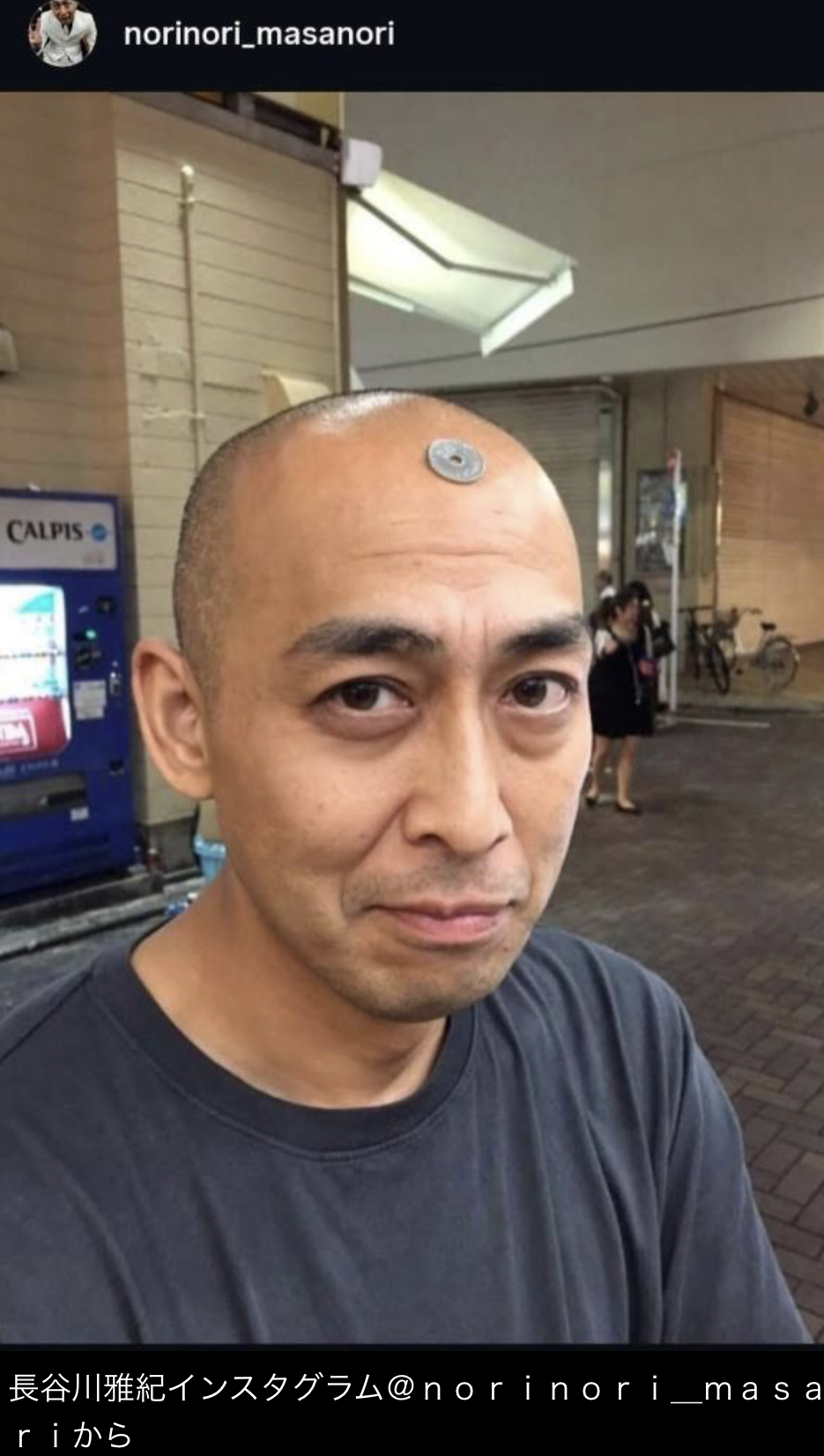 お笑いコンビ・錦鯉の長谷川雅紀さん、痩せて三島由紀夫さんみたいな顔になる （※画像あり）