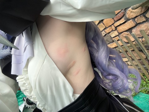 【悲報】コスプレイヤーさん、お胸を蚊に刺されまくって終わる （※画像あり）