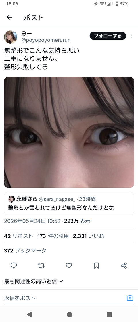 【画像】この目が整形かどうかで意見が分かれる 【画像】この目が整形かどうかで意見が分かれる