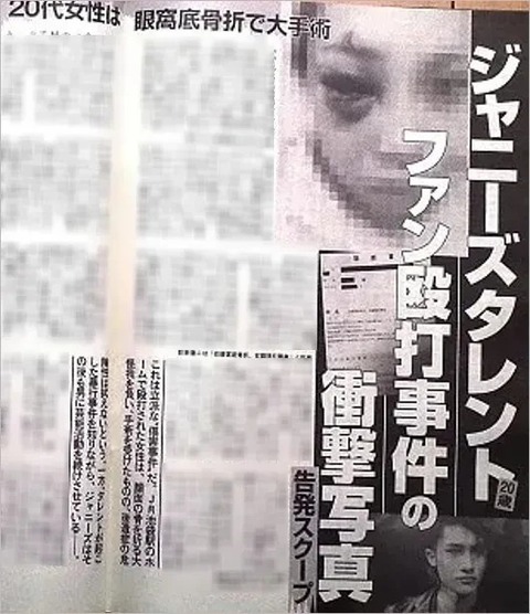 【画像】ジャ◯ーズに殴られた女、思ってた以上に怪我が酷い…