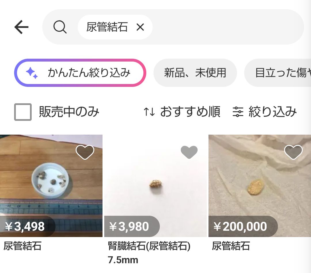 【画像】メルカリ「尿管結石ですw」ｗｗｗｗｗｗｗｗｗのサムネイル