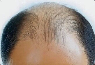 3031