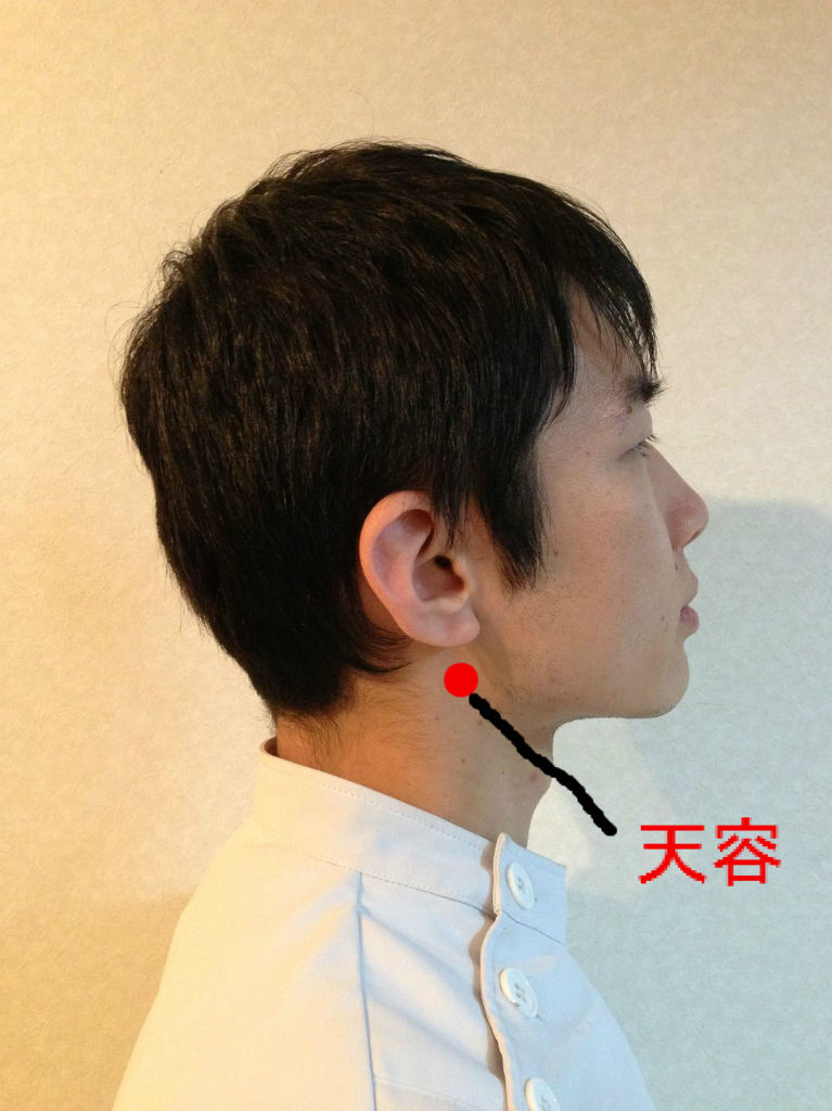 困ったときにはこんなツボ 寝違え編 海老名 整体院 楽の種 クロさんのカルテ 困ったときにはこんなツボ 寝違え編 海老名 整体院 楽の種 クロさんのカルテ