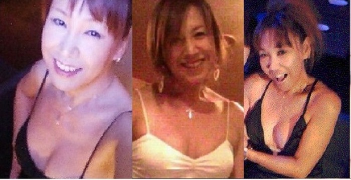女性ホルモン投与変化画像女になるまで ニューハーフit社長渡邊ひろみの性転換画像