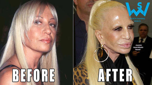 12-eye-catching-celebs-destroyed-by-plastic-surgery_2