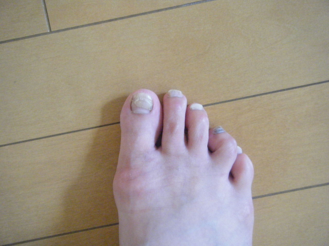 ５本指ソックス 酒呑老女のマラソン人生