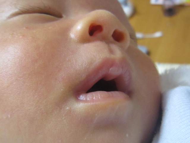 新生児 授乳後 唇 白い englsheg