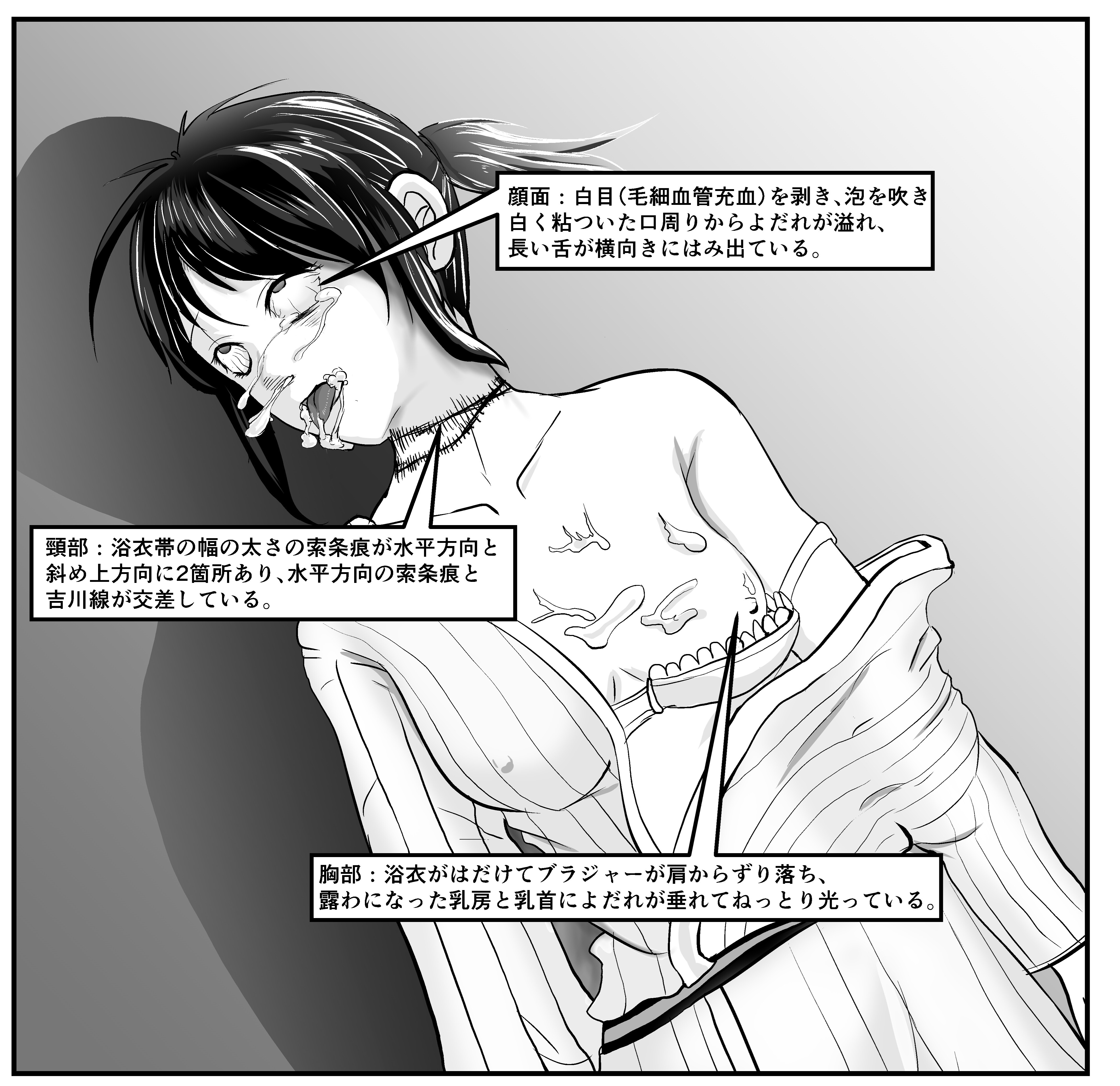 二次　失禁 