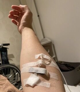 湘南美容外科で3回目の脇脱毛と4回目の美白点滴 私が笑えば子も笑う